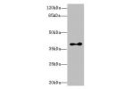 Western blot<br />
All lanes: Clavesin-2 antibody at 16ug/ml+ Mouse brain tissue<br />
Goat polyclonal to rabbit at 1/10000 dilution<br />
Predicted band size: 39,22 kDa<br />
Observed band size: 38 kDa<br />