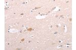 The image on the left is immunohistochemistry of paraffin-embedded Human brain tissue using CSB-PA715372(CIDEB Antibody) at dilution 1/50, on the right is treated with fusion protein. (Original magnification: 