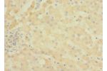 Immunohistochemistry of paraffin-embedded human liver tissue CSB-PA716402LA01HU at dilution 1:100
