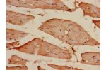 Immunohistochemistry of paraffin-embedded human skeletal muscle tissue using CSB-PA716574LA01HU at dilution of 1:100