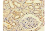Immunohistochemistry of paraffin-embedded human kidney tissue using CSB-PA719466LA01HU at dilution of 1:100