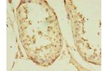 Immunohistochemistry of paraffin-embedded human testis tissue using CSB-PA719617LA01HU at dilution of 1:100