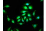 Immunofluorescence staining of A549 cells with CSB-PA721063LA01HU at 1:100,counter-stained with DAPI. The cells were fixed in 4% formaldehyde, permeabilized using 0.2% Triton X-100 and blocked in 10% normal Goat Serum. The cells were then incubated with t