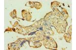 Immunohistochemistry of paraffin-embedded human placenta using CSB-PA721119ESR1HU at dilution 1:100
