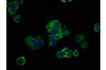 Immunofluorescence staining of MCF-7 cells with CSB-PA722558LA01HU at 1:133,counter-stained with DAPI. The cells were fixed in 4% formaldehyde, permeabilized using 0.2% Triton X-100 and blocked in 10% normal Goat Serum. The cells were then incubated with 