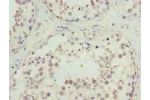 Immunohistochemistry of paraffin-embedded human testis tissue using CSB-PA722562LA01HU at dilution of 1:100