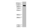 Western blot<br />
All lanes: DENND2C antibody at 8ug/ml+A431 whole cell lysate<br />
Goat polyclonal to rabbit at 1/10000 dilution<br />
Predicted band size: 107,95,101 kDa<br />
Observed band size: 107 kDa<br />