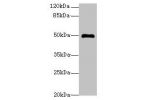Western blot<br />
All lanes: ADAL antibody at 6ug/ml+Mouse kidney tissue<br />
Goat polyclonal to rabbit at 1/10000 dilution<br />
Predicted band size: 41,31,38 kDa<br />
Observed band size: 50 kDa<br />