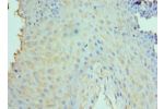 Immunohistochemistry of paraffin-embedded human tonsil using CSB-PA725176ESR2HU at dilution 1:100