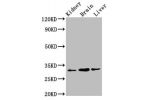 Western Blot<br />
Positive WB detected in:Rat kidney tissue,Mouse brain tissue,Mouse liver tissue<br />
All lanes:ATAT1 antibody at 6