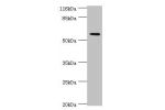 Western blot<br />
All lanes:ACBD5 antibody at 2ug/ml+Hela whole cell lysate<br />
Secondary<br />
Goat polyclonal to rabbit at 1/10000 dilution<br />
Predicted band size: 61,55,59,47 kDa<br />
Observed band size: 60 kDa<br />