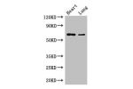 Western Blot<br />
Positive WB detected in:Mouse heart tissue,Mouse lung tissue<br />
All lanes: DCAF8 antibody at 3.5ug/ml<br />
Secondary<br />
Goat polyclonal to rabbit IgG at 1/50000 dilution<br />
Predicted band size: 67,31 kDa<br />
Observed band si