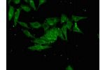 Immunofluorescent analysis of Hela cells using CSB-PA725899LA01HU at a dilution of 1:100 and Alexa Fluor 488-congugated AffiniPure Goat Anti-Rabbit IgG(H+L)