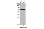Western blot analysis of mouse-lung mouse-kidney mouse-liver lysate, antibody was diluted at 500. Secondary antibody  was diluted at 1:20000