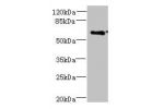 Western blot<br />
All lanes: CWF19L1 antibody at 4ug/ml+ Raji whole cell lysate<br />
Goat polyclonal to rabbit at 1/10000 dilution<br />
Predicted band size: 61,28,46 kDa<br />
Observed band size: 61 kDa<br />
