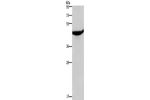 Gel: 8%SDS-PAGE,Lysate: 40 