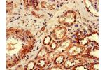 Immunohistochemistry of paraffin-embedded human kidney tissue using CSB-PA730130LA01HU at dilution of 1:100