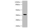 Western blot<br />
All lanes: BST1 antibody IgG at 1.47ug/ml+ Mouse lung tissue<br />
Secondary<br />
Goat polyclonal to rabbit IgG at 1/10000 dilution<br />
Predicted band size: 36,30 kDa<br />
Observed band size: 36 kDa<br />