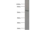 All lanes: Autophagy-related protein 16-1 antibody at 2ug/ml+MCF-7 whole cell lysate<br />
Secondary<br />
Goat polyclonal to rabbit at 1/10000 dilution<br />
Predicted band size: 69,67,54,48,50 kDa<br />
Observed band size: 68 kDa<br />