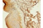 Immunohistochemistry of paraffin-embedded human skin tissue using CSB-PA734569LA01HU at dilution 1:100