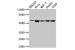 Western Blot<br />
Positive WB detected in:HEK293 whole cell lysate,Hela whole cell lysate,MCF-7 whole cell lysate,HepG2 whole cell lysate,A549 whole cell lysate<br />
All lanes:CYP4F22 antibody at 3.2