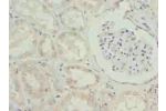 Immunohistochemistry of paraffin-embedded human kidney tissue using CSB-PA740681LA01HU at dilution of 1:100