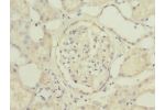 Immunohistochemistry of paraffin-embedded human kidney tissue using CSB-PA740850ESR2HU at dilution 1:100
