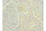 Immunohistochemistry of paraffin-embedded human kidney tissue using CSB-PA740915LA01HU at dilution of 1:100