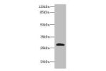 Western blot<br />
All lanes: CLEC9A antibody IgG at 8ug/ml+ Mouse kidney tissue<br />
Secondary<br />
Goat polyclonal to rabbit IgG at 1/10000 dilution<br />
Predicted band size: 27 kDa<br />
Observed band size: 27 kDa<br />