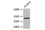 Western Blot<br />
Positive WB detected in:Mouse kidney tissue<br />
All lanes: FAM151B antibody at 2.6ug/ml<br />
Secondary<br />
Goat polyclonal to rabbit IgG at 1/50000 dilution<br />
Predicted band size: 32 kDa<br />
Observed band size: 32 kDa<br />