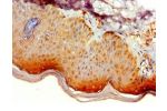 Immunohistochemistry of paraffin-embedded human skin using CSB-PA741052ESR2HU at dilution 1:100