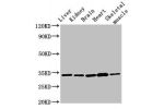 Western Blot<br />
Positive WB detected in:Rat liver tissue,Rat kidney tissue,Mouse brain tissue,Mouse heart tissue,Mouse skeletal muscle tissue<br />
All lanes:AHSA2 antibody at 3