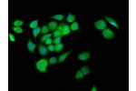 Immunofluorescence staining of A549 cells with CSB-PA741972LA01HU at 1:133,counter-stained with DAPI. The cells were fixed in 4% formaldehyde, permeabilized using 0.2% Triton X-100 and blocked in 10% normal Goat Serum. The cells were then incubated with t