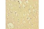 Immunohistochemistry of paraffin-embedded human brain tissue using CSB-PA741975LA01HU at dilution 1:100