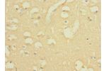 Immunohistochemistry of paraffin-embedded human brain tissue CSB-PA743592LA01HU at dilution 1:100