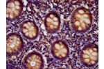 IHC image of CSB-PA744034LA01HU diluted at 1:400 and staining in paraffin-embedded human appendix tissue performed on a Leica BondTM system. After dewaxing and hydration, antigen retrieval was mediated by high pressure in a citrate buffer (pH 6.0). Sectio