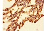 Immunohistochemistry of paraffin-embedded human lung tissue using CSB-PA744268LA01HU at dilution of 1:100