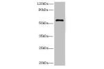 Western blot<br />
All lanes: GK5 antibody at 4ug/ml+ K562 whole cell lysate<br />
Goat polyclonal to rabbit at 1/10000 dilution<br />
Predicted band size: 60,34,28 kDa<br />
Observed band size: 59 kDa<br />