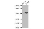 Western Blot<br />
Positive WB detected in:Mouse brain tissue,Mouse liver tissue<br />
All lanes:CHST9 antibody at 2.8