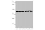 Western blot<br />
All lanes:EIF3M antibody at 2.02 ug/ml<br />
Lane 1 : Hela whole cell lysate<br />
Lane 2 : A549 whole cell lysate<br />
Lane 3 : Mouse gonadal tissue<br />
Lane 4 : Human placenta tissue<br />
Lane 5 : Mouse stomach tissue<br />
Lane 6