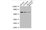 Western Blot<br />
Positive WB detected in:Mouse spleen tissue,Mouse stomach tissue,Mouse skeletal muscle tissue<br />
All lanes: MCR-1 antibody at 2.5ug/ml<br />
Secondary<br />
Goat polyclonal to rabbit IgG at 1/50000 dilution<br />
Predicted band size: