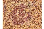 Immunohistochemistry of paraffin-embedded human spleen tissue using CSB-PA747468LA01HU at dilution of 1:100