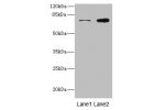 Western blot<br />
All lanes: DARS2 antibody at 10ug/ml<br />
Lane 1 : A549 whole cell lysate<br />
Lane 2 : MCF7 whole cell lysate<br />
Secondary<br />
Goat polyclonal to rabbit IgG at 1/10000 dilution<br />
Predicted band size: 74 kDa<br />
Observed ba
