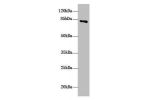 Western Blot<br />
All lanes: DHX32 antibody at 10 ug/ml+ Mouse liver tissue<br />
Secondary<br />
Goat polyclonal to rabbit IgG at 1/10000 dilution<br />
Predicted band size: 85,76 kDa<br />
Observed band size: 84 kDa<br />