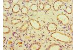 Immunohistochemistry of paraffin-embedded human kidney using CSB-PA748726ESR2HU at dilution 1:100