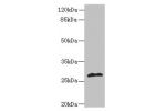 Western blot<br />
All lanes: fabI antibody at 5ug/ml+Mouse heart tissue<br />
Goat polyclonal to rabbit at 1/10000 dilution<br />
Predicted band size: 28 kDa<br />
Observed band size: 28 kDa<br />