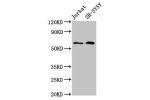 Western Blot<br />
Positive WB detected in:Jurkat whole cell lysate,SH-SY5Y whole cell lysate<br />
All lanes:BORA antibody at 4.8