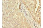 Immunohistochemistry of paraffin-embedded human liver tissue using CSB-PA752098LA01HU at dilution of 1:100