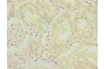 Immunohistochemistry of paraffin-embedded human kidney tissue using CSB-PA752102LA01HU at dilution of 1:100