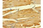 Immunohistochemistry of paraffin-embedded human skeletal muscle tissue using CSB-PA753612LA01HU at dilution 1:100